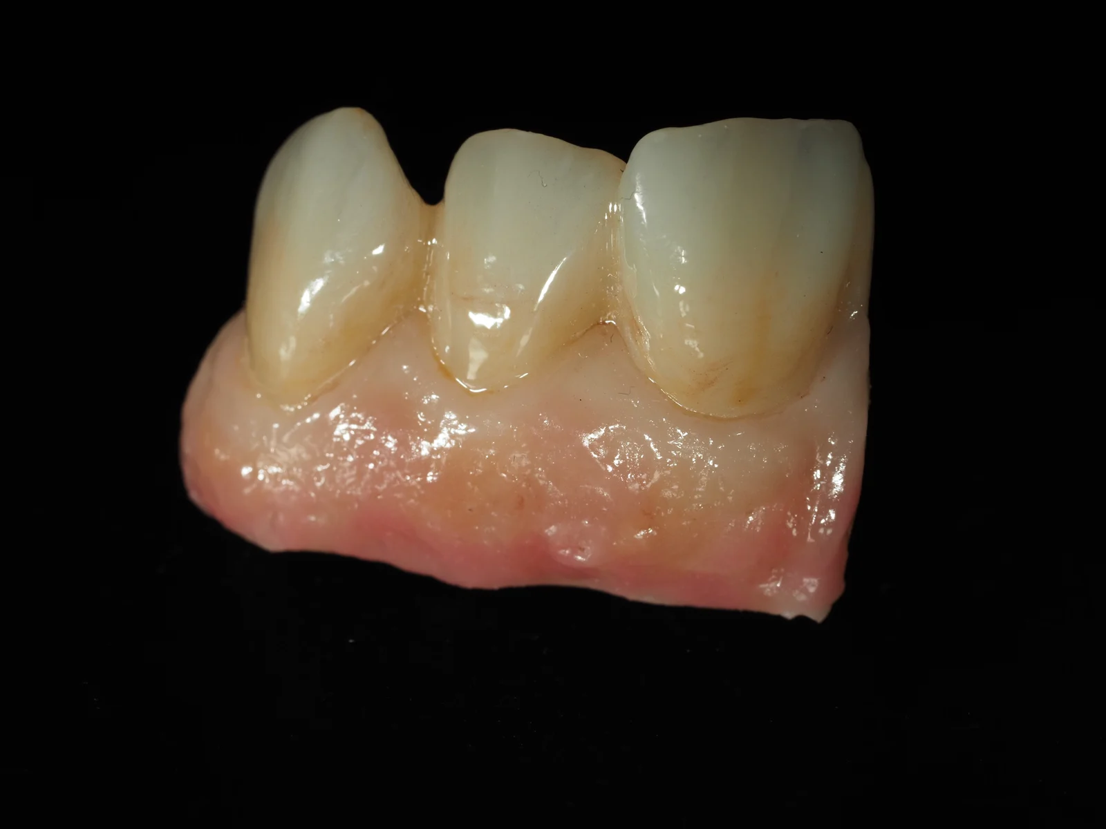 Detal pracy protetycznej GRZESZNIK DENTAL STUDIO